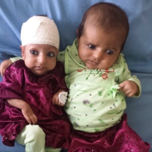 A bebê de três meses Asree Gul (esquerda) e sua irmã gêmea em hospital no Afeganistão - AFP
