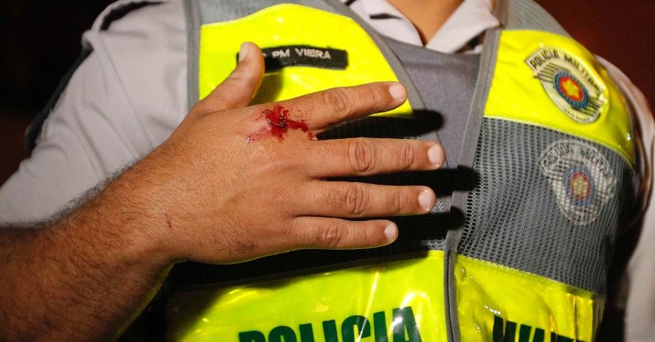 15.out.2013 - Policial militar mostra ferimento sofrido durante protesto contra a política educacional do governo de Geraldo Alckmin. A manifestação teve início no início da noite no largo da Batata, em Pinheiros. Manifestantes entraram em confronto com a polícia, que usou bombas de gás lacrimogêneo e efeito moral