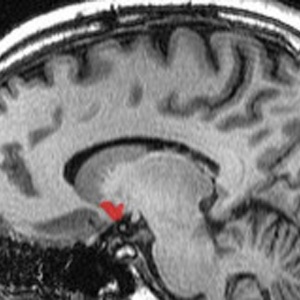 Estímulo cerebral provocado por orgasmos traz vários benefícios, segundo Komisaruk - BBC