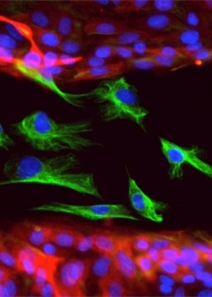 30.out,2013 - Células epiteliais (em vermelho) e mesenquimais (verde): as primeiras não são capazes de migrar como as segundas - Christina Scheel/Whitehead Institute
