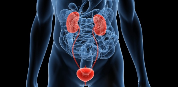 Nos casos de dores e cólicas renais, os pacientes com cálculos renais devem procurar o médico  - Getty Images/Hemera