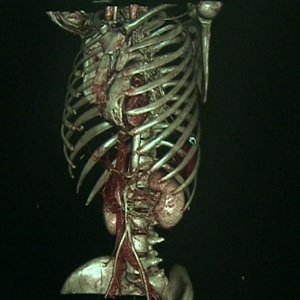 O escâner em 3D permitirá que autopsias sejam feitas digitalmente, sem a necessidade de um corte - BBC