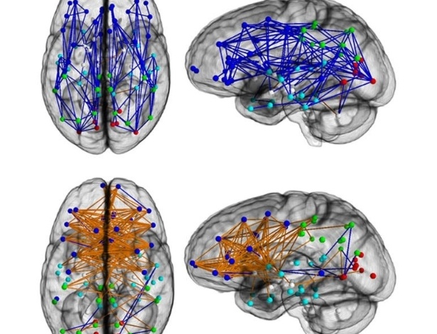 Conexões cerebrais mostram maiores ligações da frente para trás e em um hemisfério nos homens (em cima) e da esquerda para direita nas mulheres (abaixo), aponta estudo publicado na Pnas - Ragini Verma, Ph.D., Proceedings of National Academy of Sciences