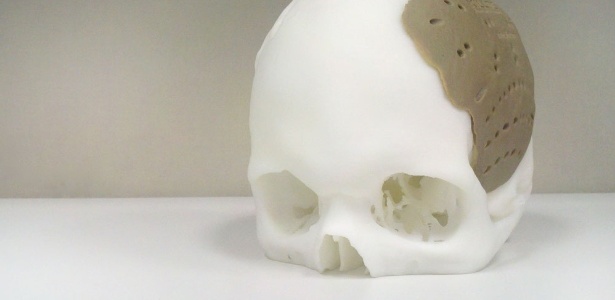 Crânio feito com impressora 3D; equipamento está começando a ser usando para criar ossos e até vasos sanguíneos - Gizmodo