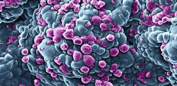 Células de câncer de mama sendo submetidas a medicamentos - Khuloud T Al-Jamal e Izzat Suffian/Wellcome Images