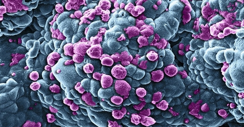 12.mar.2014 - A imagem acima mostra células de câncer de mama sendo submetidas a medicamentos; a autoria é de Khuloud T Al-Jamal e Izzat Suffian