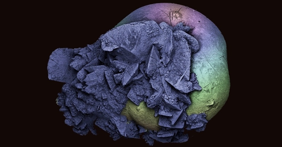 12.mar.2014 - Kevin Mackenzie foi selecionado também com esta imagem, de um exame micrográfico mostrando os detalhes de uma pedra no rim