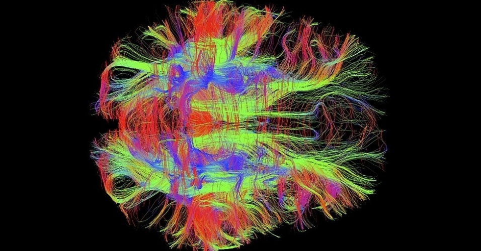 12.mar.2014 - Zeynep M Saygin, do Instituto McGovern, que fica no Massachussets Institute for Technologia (MIT), fez esta incrível ressonância magnética de fibras de nervos no cérebro de um adulto saudável