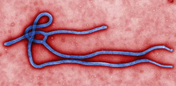 Micrografia eletrônica colorida de transmissão feita nos EUA mostra um pouco da morfologia de uma partícula viral do Ebola; vírus pode levar à morte - Cynthia Goldsmith/AFP Photo /Divulgação/CDC