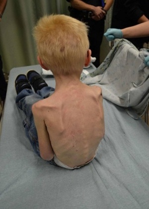 Médicos do Hospital Infantil do Texas examinam criança desnutrida encontrada por policiais trancada dentro de um armário em uma casa no Texas (EUA) - Divulgação/Reprodução The Independent