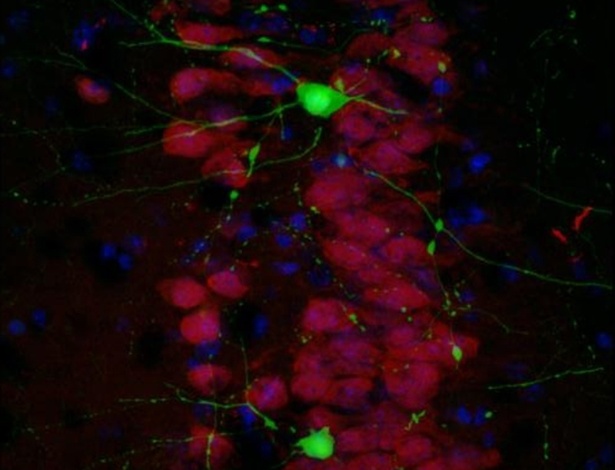 A proteína "Crtc1", responsável pela formação de memória a longo prazo, pode ser vista nos cérebros dos ratos com Alzheimer (em verde) - Universitat Autonoma de Barcelona