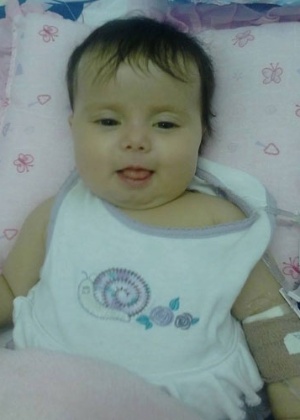 EUA: bebê brasileira com síndrome rara consegue transplante