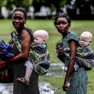 Mulheres carregam bebês albinos em Dar es Salaam, na Tanzânia - Bunyamin Aygun/AFP