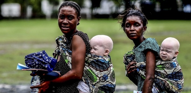 Mulheres carregam bebês albinos em Dar es Salaam, na Tanzânia - Bunyamin Aygun/AFP