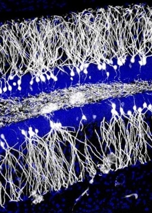 Neurônios recém-nascidos no giro denteado do hipocampo (na imagem) podem apagar memórias antigas e ajudar a criar novas, indica estudo feito em ratos e publicado na revista Science - Jason Snyder/Science
