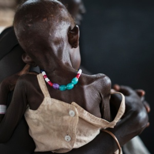 Elizabeth Garyang e sua filha, Nyajuba, 2, ambas mal nutridas, são atendidas em uma clínica da ONG Médicos Sem Fronteiras em Juba (Sudão do Sul) - Lynsey Addario/The New York Times