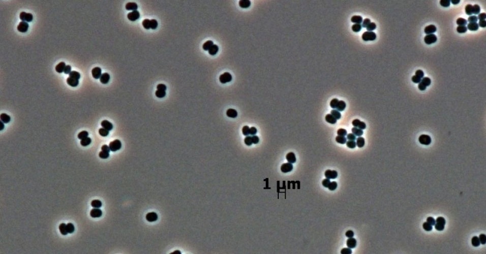 23.mai.2014 - Essas bactérias ("Tersicoccus phoenicis") recém-descobertas são conhecidas como micróbios do quarto limpo, porque resistem a esterilizações em alguns locais