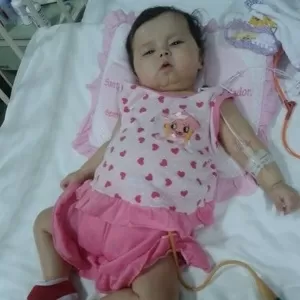 EUA: bebê brasileira com síndrome rara consegue transplante