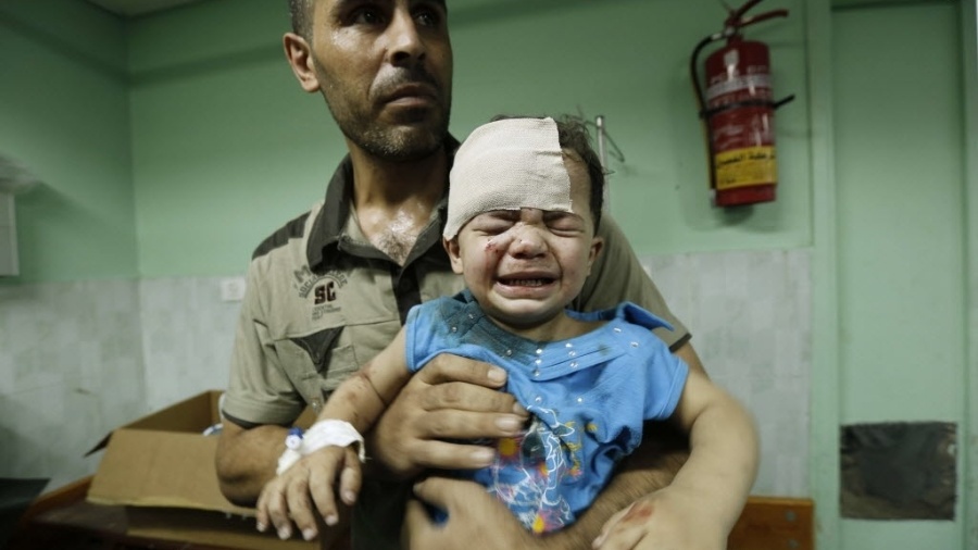 30.jul.2014 - Criança palestina, ferida em um ataque israelense contra uma escola da ONU no campo de refugiados de Jabaliya, no norte da faixa de Gaza, recebe tratamento no hospital Kamal Edwan, em Beit Lahia