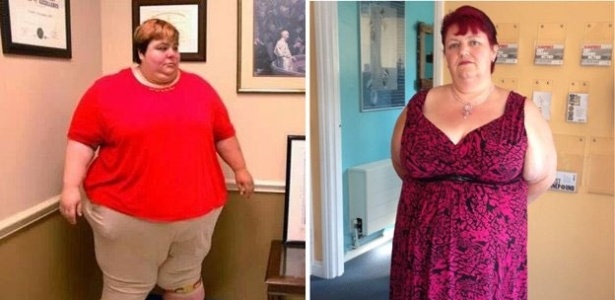 Após uma cirurgia bariátrica, a britânica Zaneta Jones perdeu 160 quilos - BBC/Arquivo pessoal