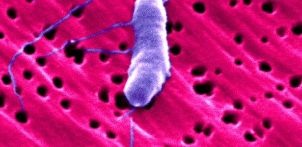 Nesta micrografia de elétrons colorizada pode-se ver a bactéria Vibrio vulnificus, conhecida como bactéria devoradora de carne humana - Divulgação
