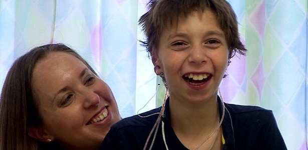O garoto britânico Kieran Sorkin nasceu com uma anomalia genética chamada microtia, que caracteriza malformação das orelhas - BBC