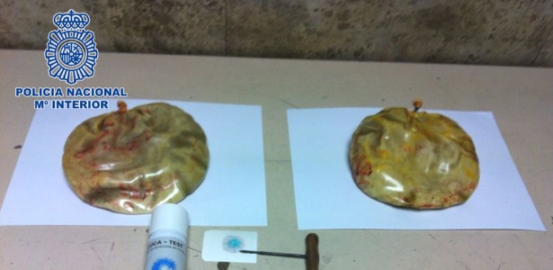 Próteses de silicone foram preenchidas com 1,7 kg de cocaína e implantadas - Divulgação/Polícia Nacional da Espanha/AFP