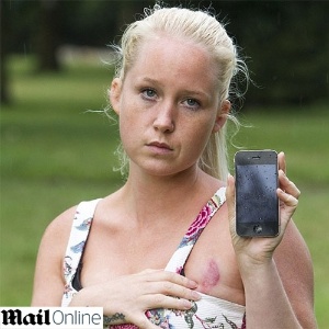 Dionne Baxter, 24, teve uma queimadura no seio causada por um iPhone 4 - Reprodução/Daily Mail