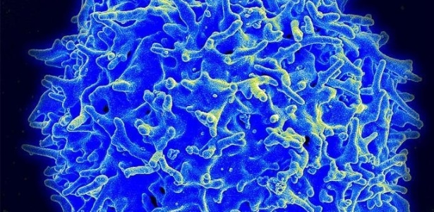 Micrografia de uma célula T - Reprodução
