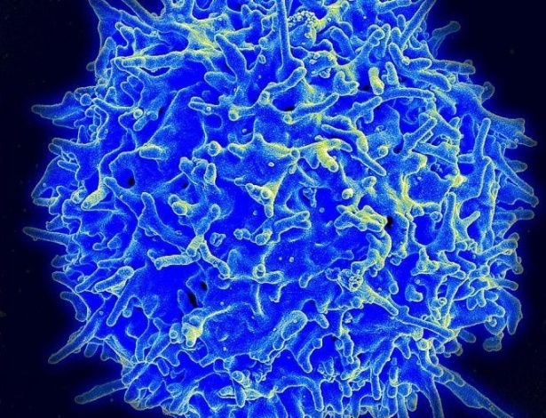 Micrografia de um escaneamento de elétron de um célula T: mais perto de prevenir herpes - Reprodução