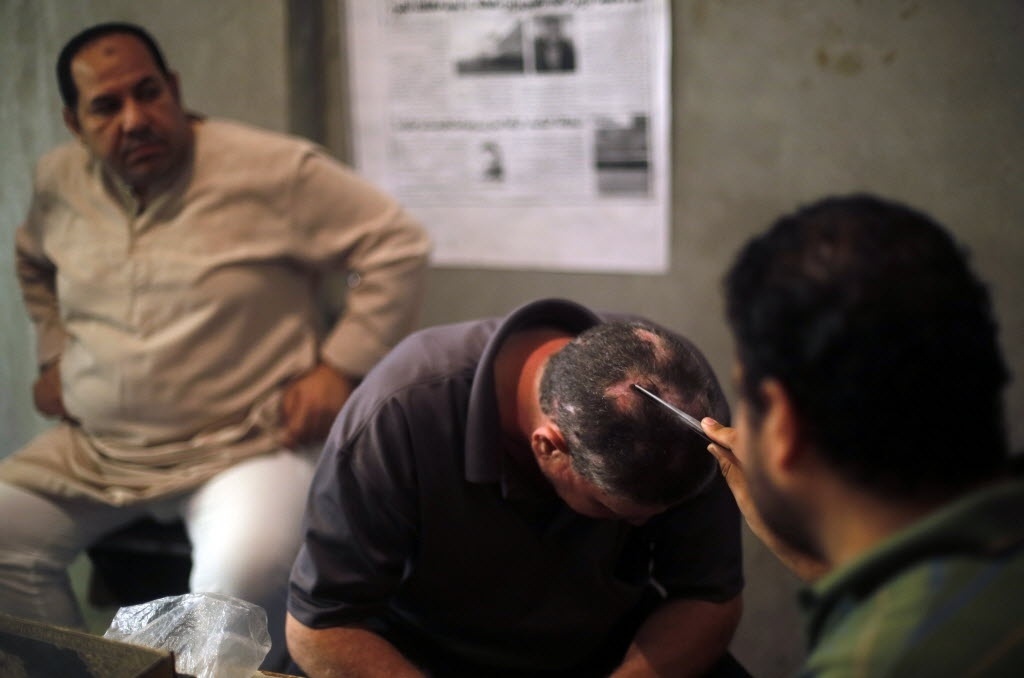 1º.set.2014 - Ibrahim Al Saied Sayeeh coloca uma abelha na cabeça de um homem que sofre de alopecia, isto é, redução parcial ou total de pelos ou cabelos em uma determinada área de pele, no centro aberto por seu pai, Haj Saied Al Sayeeh, no Cairo (Egito). O pai de Ibrahim acredita que o veneno das abelhas tem propriedades especiais, que, quando utilizadas em partes específicas do corpo, pode curar doenças como problemas renais, apendicite e até câncer - Amr Abdallah Dalsh/Reuters