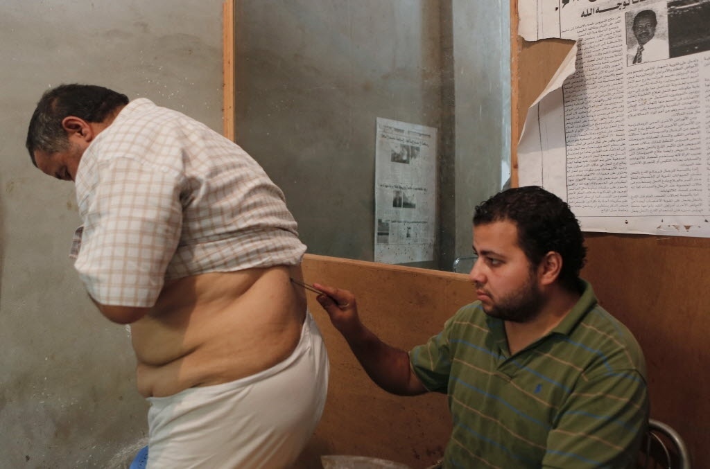 1º.set.2014 - Ibrahim Saied Al Sayeeh aproxima uma abelha das costas de um homem que sofre de problemas nas costas e na coluna vertebral, no centro aberto por seu pai, Haj Saied Al Sayeeh, no Cairo (Egito). Al Sayeeh acredita que o veneno das abelhas tem propriedades especiais, que, quando utilizadas em partes específicas do corpo, pode curar doenças como problemas renais, apendicite e até câncer - Amr Abdallah Dalsh/Reuters