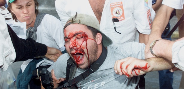 Fotógrafo do jornal Agora S.Paulo, Alex Silveira foi atingido no olho por bala de borracha durante protesto de funcionários da rede publica de ensino, saúde e transportes em SP  - Caio Guatelli - 18.mai.2000/Folha Imagem