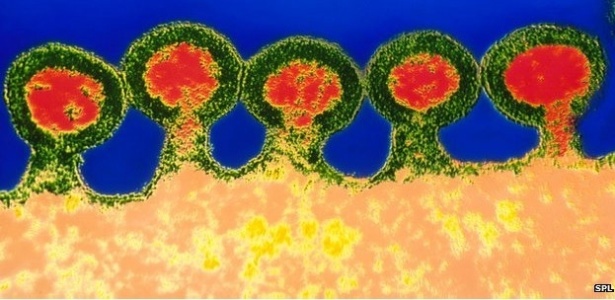 Imagem mostra o vírus HIV ampliado em microscópio, em foto sem data - SPL