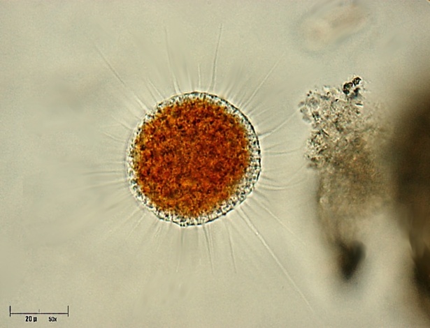 Vampyrella lateritia, um cercozoano da família Vampyrellidae: vampiro-ameba - Giuseppe Vago/Wikipedia
