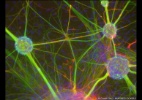 Fotos ilustram "caminhos" do cérebro em pesquisas sobre Parkinson - Rowan Orme/Universidade de Keel