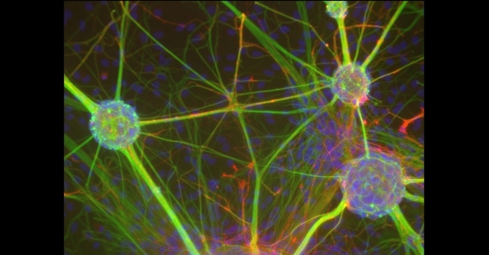 13.nov.2014 - A imagem de uma "rodovia" cerebral formada por um nervo iluminado, de autoria de Rowan Orme, da Universidade de Keel (Reino Unido), venceu o concurso "Retratando Parkinson", da associação britânica Parkinson's UK