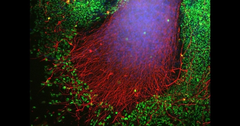 13.nov.2014 - "A proteína alfa-sinucleína, em vermelho na foto, foi capturada nesta imagem em uma área do cérebro chamada cerebelo. Entender como ela se aglomera e causa a morte de células nervosas pode levar ao desenvolvimento de novos tratamentos contra a doença", diz Drummond