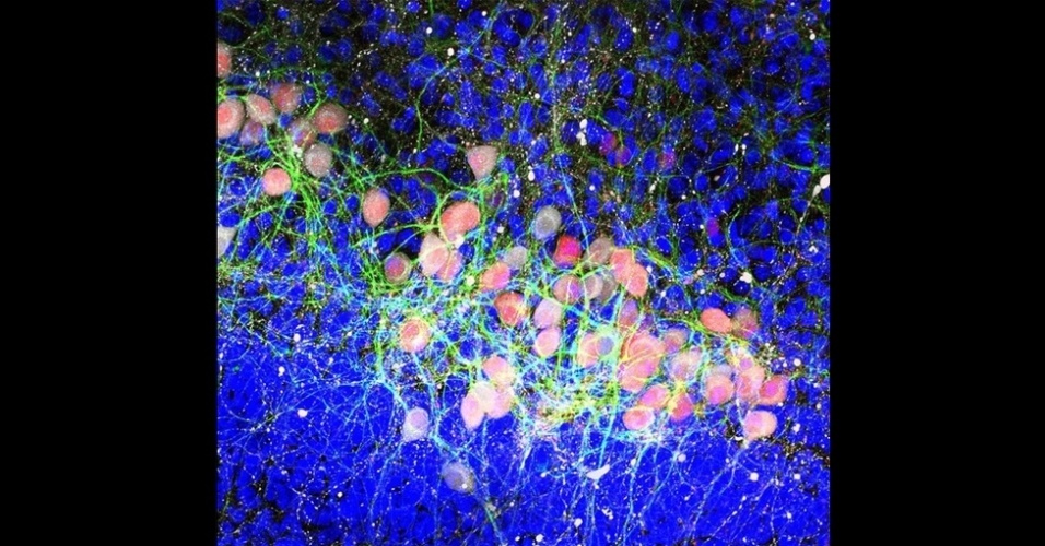 13.nov.2014 - A vice-campeã foi Nicola Drummond, da Universidade de Edimburgo, pela imagem acima, que mostra o acúmulo de proteína no cérebro. "Belas imagens como esta estariam em casa, mas são na verdade o produto de incansáveis pesquisas para descobrir o que acontece em centenas de milhões de células nervosas afetadas pela doença de Parkinson", diz o diretor da Parkinson's UK, Arthur Roach