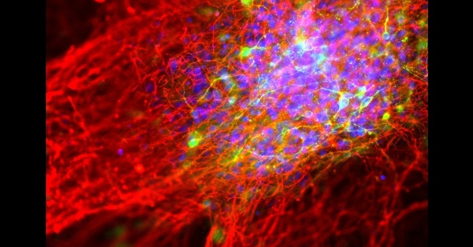 13.nov.2014 - Esta imagem revela a transformação de células de pele (tiradas de portadores de Parkinson) em neurônios em laboratório. "Uma vez que essas células são criadas, ganham enorme potencial como ferramenta na pesquisa da doença", diz Fernandes