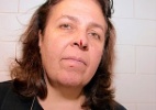 Mulher tem nariz ferido por hélice de drone em restaurante nos EUA - Reprodução/Brooklyn Daily