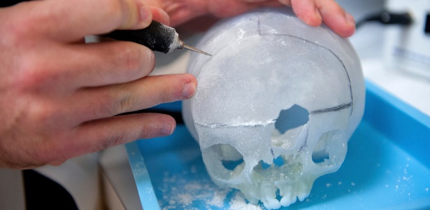 O médico John Meara corta modelo 3D de crânio de Violet Pietrok, que nasceu com uma fissura facial. O modelo do crânio foi baseado em imagens de ressonância magnética, e permite que os cirurgiões possam prever problemas, e não lidar com eles na hora da cirurgia - Katherine C. Cohen/Boston Children"s Hospital/The New York Times