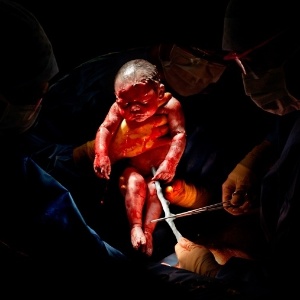 O fotógrafo Christian Berthelot clicou bebês segundos após o nascimento. Na foto, Liza, que nasceu em 26 de fevereiro de 2013, às 8h45. A foto foi tirada 3 segundos depois do nascimento - Christian Berthelot