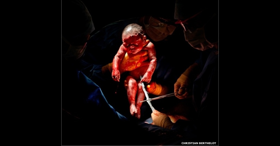 18.fev.2015 - Alguns dos bebês tiveram um nascimento mais tranquilo que outros, mas segundo o fotógrafo Christian Berthelot, "todos sobreviveram". Na foto, Liza, 26 de fevereiro de 2013, 8h45, 3,2 quilos, 3 segundos depois do nascimento
