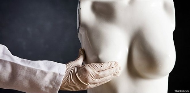 Evolução de técnicas, facilidade no procedimento e motivos de saúde levam mulheres a diminuir mamas - Thinkstock