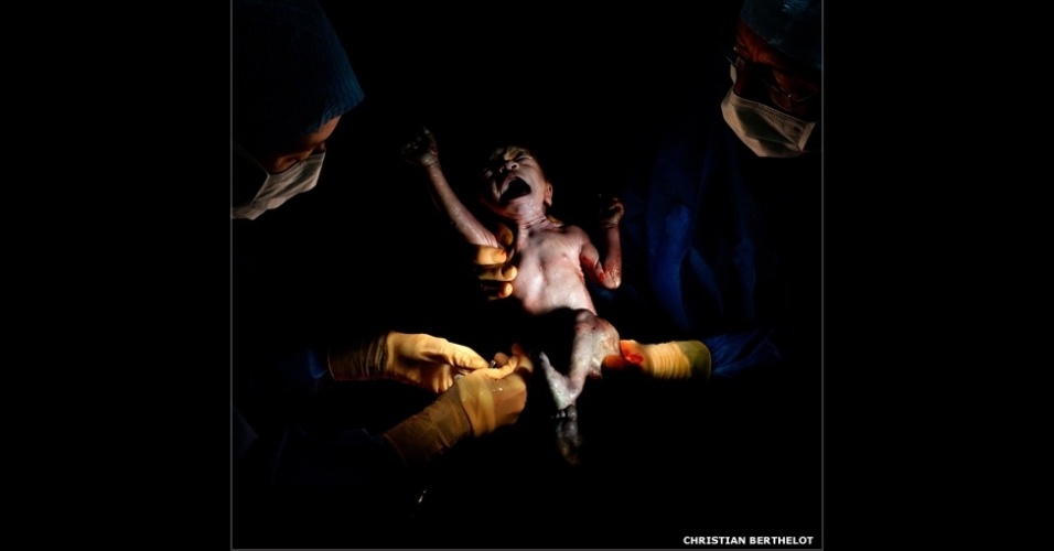 18.fev.2015 - O fotógrafo francês Christian Berthelot capturou os primeiros momentos logo depois do parto em uma série de retratos de recém-nascidos em um projeto que ele batizou de "Cesar". Na imagem, Steven, nascido em 21 de dezembro de 2013, 16h31, 2,425 quilos, 15 segundos depois do nascimento