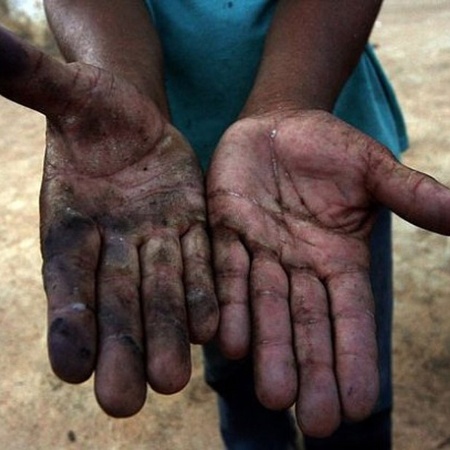Trabalhador rural de uma plantação de mandioca no município de Pesqueira, em Pernambuco, exibe suas mãos machucadas devido a condições de trabalho análogas à escravidão - Alejandro Arigón/IPS