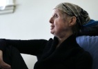 EUA estudam mulher que recebeu transplante de rosto - Charles Krupa/AP