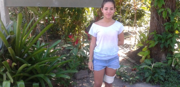 Rebeca Leite, de 20 anos, foi atacada por uma matilha de cães no campus da UFRJ - Maria Luisa Melo/UOL