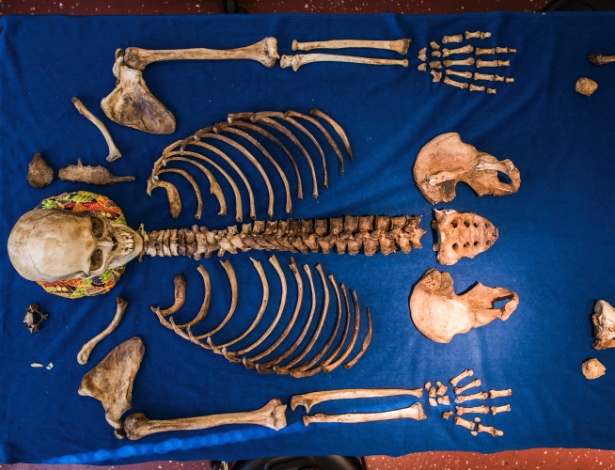  Restos mortais são dispostos no laboratório de antropologia forense na Universidade de Western Carolina, em Cullowhee, na Carolina do Norte - Mike Belleme/The New York Times